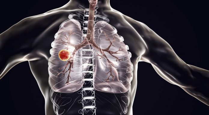 Posodobljeni standardi EU za zdravljenje bolnikov s tuberkulozo