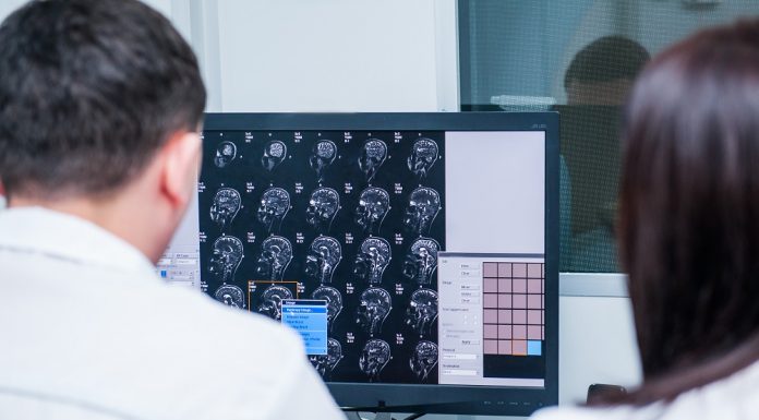 Krvni test odkrije pretres možganov v 15 minutah