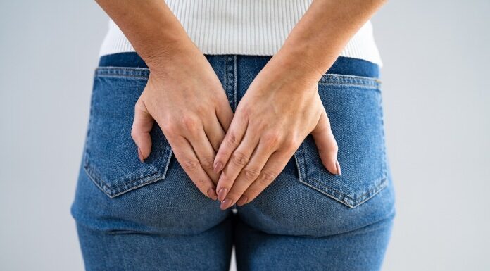 Hemoroidi so žilne blazinice, ki predstavljajo normalno anatomsko strukturo.