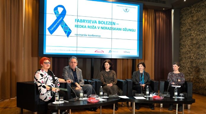 Omizje iz tiskovne konference