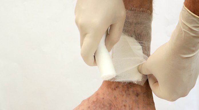 Kronične rane na nogi