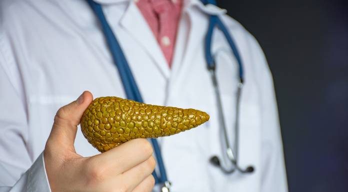 Rak trebušne slinavke