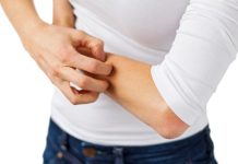 Atopijski dermatitis obravnavamo interdisciplinarno