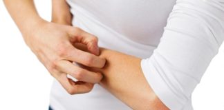 Atopijski dermatitis obravnavamo interdisciplinarno