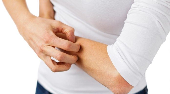 Atopijski dermatitis obravnavamo interdisciplinarno