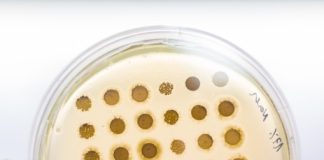 Glivične okužbe z dermatofiti