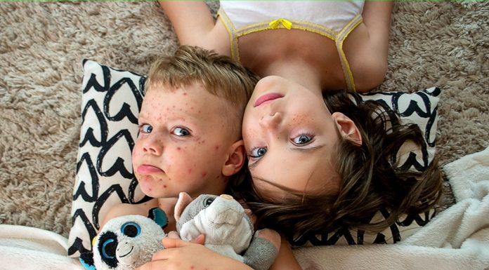 Ko zboli otrok, tik pred odhodom na dopust Otrok z noricami doma ob sorojencu